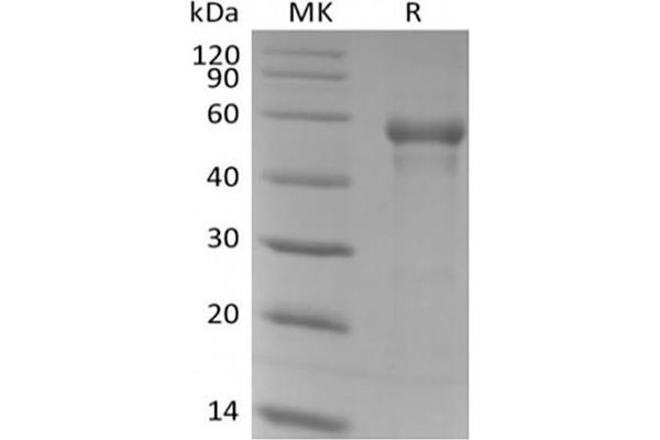 CD57 Protein (His tag)