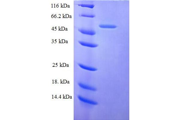 TMEM25 Protein (AA 27-322, Isoform 2) (His-SUMO Tag)