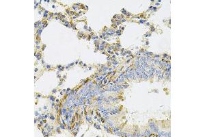 Immunohistochemistry of paraffin-embedded rat lung using UBE2B Antibody. (UBE2B Antikörper)