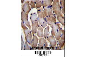 SEPN1 Antibody immunohistochemistry analysis in formalin fixed and paraffin embedded human skeletal muscle followed by peroxidase conjugation of the secondary antibody and DAB staining. (SEPN1 Antikörper  (C-Term))