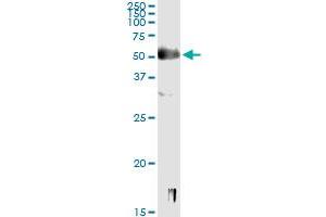 Immunoprecipitation (IP) image for anti-SRY (Sex Determining Region Y)-Box 9 (SOX9) (AA 400-509) antibody (ABIN520382)