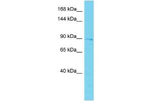 Host: Rabbit Target Name: EPS15L1 Sample Type: Placenta lysates Antibody Dilution: 1. (EPS15L1 Antikörper  (C-Term))