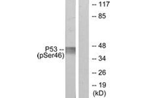 Western blot analysis of extracts from 293 cells treated with UV, using p53 (Phospho-Ser46) Antibody. (p53 Antikörper  (pSer46))