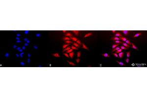 Immunocytochemistry/Immunofluorescence analysis using Rabbit Anti-SOD (Cu/Zn) Polyclonal Antibody . (SOD1 Antikörper  (Atto 594))