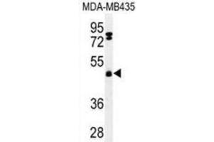 Western Blotting (WB) image for anti-F-Box and Leucine-Rich Repeat Protein 2 (FBXL2) antibody (ABIN3002209) (FBXL2 Antikörper)