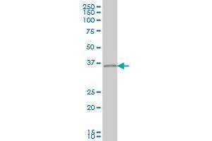 CRX monoclonal antibody (M04), clone 6D11 Western Blot analysis of CRX expression in PC-12 . (CRX Antikörper  (AA 1-95))