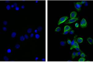 Human pancreatic carcinoma cell line MIA PaCa-2 was stained with Mouse Anti-Cytokeratin 18-UNLB and DAPI. (Ratte anti-Maus IgG2b Antikörper (FITC))