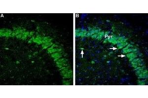 Expression of GABRA5 in mouse brain - Immunohistochemical staining of mouse hippocampus sections using Anti-GABA(A) α5 Receptor Antibody (ABIN7043189, ABIN7044317 and ABIN7044318), (1,600). (GABRA5 Antikörper  (2nd Cytoplasmic Loop))