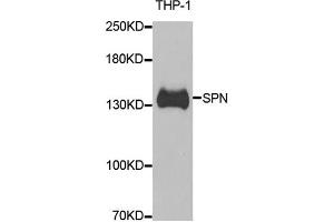 Western blot analysis of extracts of THP-1 cells, using SPN antibody. (CD43 Antikörper)