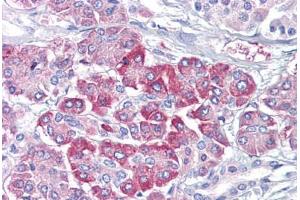 Anti-NRAS antibody IHC staining of human pancreas. (GTPase NRas Antikörper)
