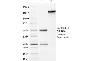 SDS-PAGE Analysis Purified Filaggrin Mouse Monoclonal Antibody (FLG/1561). (Filaggrin Antikörper  (AA 198-288))