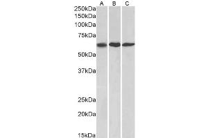 Western Blotting (WB) image for anti-Matrix Metallopeptidase 14 (Membrane-inserted) (MMP14) antibody (ABIN5928778) (MMP14 Antikörper)