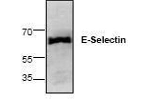 Image no. 1 for anti-Selectin E (SELE) antibody (ABIN127258) (Selectin E/CD62e Antikörper)