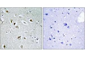 Immunohistochemistry analysis of paraffin-embedded human brain tissue, using CDKA2 Antibody. (CDK2AP2 Antikörper  (AA 51-100))