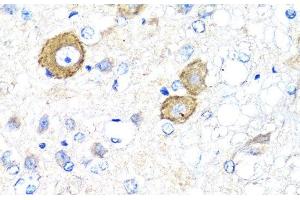 Immunohistochemistry of paraffin-embedded Rat brain using NRG4 Polyclonal Antibody at dilution of 1:100 (40x lens). (Neuregulin 4 Antikörper)