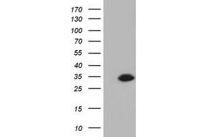 HEK293T cells were transfected with the pCMV6-ENTRY control (Left lane) or pCMV6-ENTRY KHK (Right lane) cDNA for 48 hrs and lysed. (Ketohexokinase Antikörper)