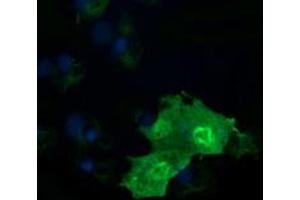 Image no. 2 for anti-RAB37, Member RAS Oncogene Family (RAB37) antibody (ABIN1500562) (RAB37 Antikörper)