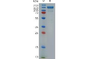 Human IL17RB Protein, His Tag on SDS-PAGE under reducing condition. (ITGB1 Protein (AA 21-728) (Fc Tag))
