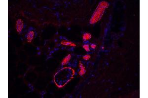 human sole sweat gland (courtesy of L. (KRT17 Antikörper)