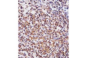 (ABIN1536600 and ABIN2843823) staining MS4A1/CD20 in human tonsil tissue sections by Immunohistochemistry (IHC-P - paraformaldehyde-fixed, paraffin-embedded sections). (CD20 Antikörper  (C-Term))