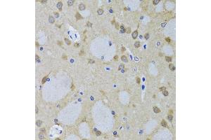 Immunohistochemistry of paraffin-embedded mouse brain using YWHAZ antibody. (14-3-3 zeta Antikörper)