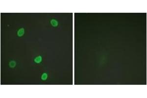 Immunofluorescence (IF) image for anti-Histone H4 (acLys8) antibody (ABIN2890733) (Histone H4 Antikörper  (acLys8))