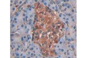 IHC-P analysis of Human Tissue, with DAB staining. (MTR Antikörper  (AA 923-1265))