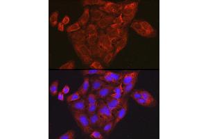 Immunofluorescence analysis of U-2 OS cells using CCL3 Rabbit pAb (ABIN6130184, ABIN6138061, ABIN6138062 and ABIN6223474) at dilution of 1:100 (40x lens). (CCL3 Antikörper  (AA 24-92))