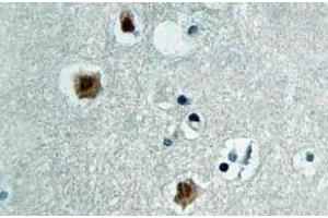 Immunohistochemistry (IHC) analyzes of PAKbeta antibody in paraffin-embedded human brain tissue. (PAK3 Antikörper)