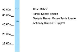 Host: Rabbit Target Name: SMAD4 Sample Tissue: Mouse Testis Antibody Dilution: 1ug/ml (SMAD4 Antikörper  (C-Term))