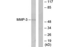 Western Blotting (WB) image for anti-Matrix Metallopeptidase 3 (Stromelysin 1, Progelatinase) (MMP3) (AA 421-470) antibody (ABIN2889233) (MMP3 Antikörper  (AA 421-470))