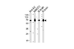 Western blot analysis of lysates from H-4-II-E, mouse NIH/3T3 cell line, mouse brain and rat brain tissues (from left to right), using STIP1 Antibody at 1:1000 at each lane. (STIP1 Antikörper  (C-Term))
