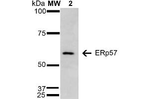 Western Blot analysis of Human Cervical Cancer cell line (HeLa) showing detection of 57 kDa Erp57 protein using Mouse Anti-Erp57 Monoclonal Antibody, Clone 4F9 . (PDIA3 Antikörper  (AA 25-505) (Atto 594))