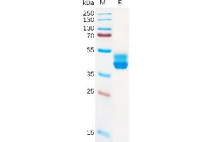 Human CB2 Protein, hFc Tag on SDS-PAGE under reducing condition. (CNR2 Protein (AA 1-33) (Fc Tag))