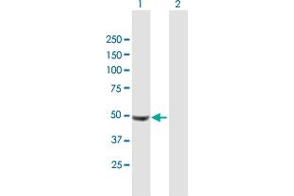 UCKL1 Antikörper  (AA 1-419)