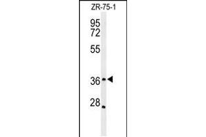 Western blot analysis of MIIP Antibody in ZR-75-1 cell line lysates (35ug/lane) (MIIP Antikörper  (C-Term))