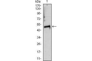 Western Blotting (WB) image for anti-Tubulin, alpha 8 (TUBA8) antibody (ABIN969446)