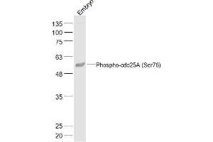 Mouse Embryo lysates probed with Phospho-cdc25A (Ser76) Polyclonal Antibody, Unconjugated  at 1:500 dilution and 4˚C overnight incubation. (CDC25A Antikörper  (pSer76))