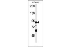 Western blot analysis of LRRC36 Antibody (N-term) in mouse heart tissue lysates (35ug/lane). (LRRC36 Antikörper  (N-Term))