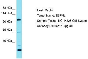 Host: Rabbit Target Name: ESPNL Sample Tissue: Human NCI-H226 Whole Cell Antibody Dilution: 1ug/ml (ESPNL Antikörper  (C-Term))