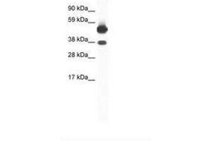 Image no. 1 for anti-Thyroid Hormone Receptor, beta (THRB) (AA 53-102) antibody (ABIN6736050) (THRB Antikörper  (AA 53-102))