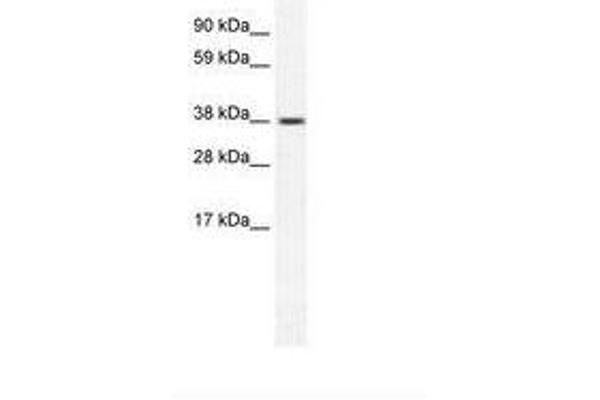 TRPM3 Antikörper  (AA 201-250)