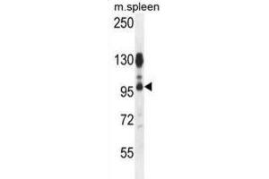 Western Blotting (WB) image for anti-ArfGAP with Coiled-Coil, Ankyrin Repeat and PH Domains 1 (ACAP1) antibody (ABIN2996040) (ACAP1 Antikörper)