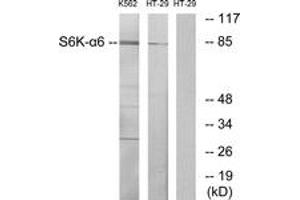 Western Blotting (WB) image for anti-Ribosomal Protein S6 Kinase, 90kDa, Polypeptide 6 (RPS6KA6) (AA 661-710) antibody (ABIN2889803) (RPS6KA6 Antikörper  (AA 661-710))