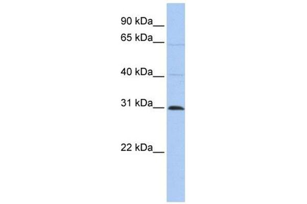 METTL11B Antikörper  (C-Term)