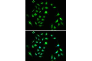 Immunofluorescence analysis of A549 cell using CHUK antibody. (IKK alpha Antikörper)