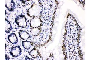 Anti- Cdk9 Picoband antibody, IHC(P) IHC(P): Rat Intestine Tissue (CDK9 Antikörper  (AA 141-372))