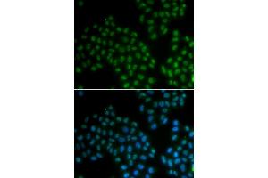 Immunofluorescence analysis of A549 cells using SOX2 antibody. (SOX2 Antikörper)