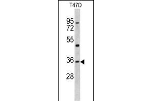 KLF6 Antikörper  (N-Term)