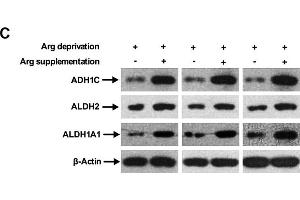 Arg supplementation activates ethanol degradation pathways in HepG2 cells. (ADH1C Antikörper  (AA 1-375))
